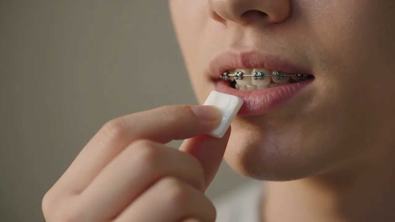 Jak se používá vosk na rovnátka: průvodce pro pohodlnější nošení