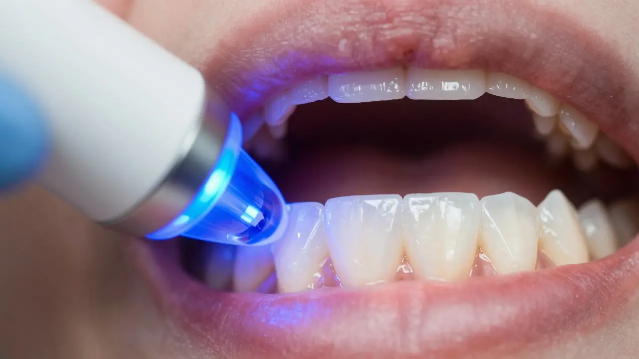 Zubní bělení aktivované modrým světlem LED přístroje pro okamžité výsledky